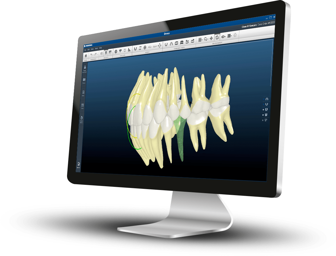 Insignia™ - das digitale Behandlungssystem